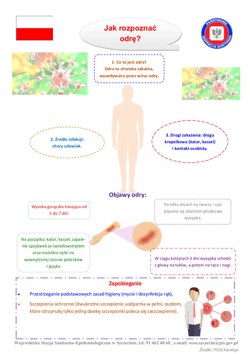 Komunikat nt. ogniska oraz zachorowań na odrę w województwie zachodniopomorskim