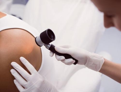 Podsumowanie akcji Bezpłatnych Badań Dermatoskopowych w Powiecie Polickim